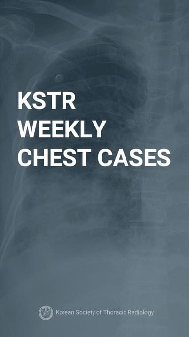 KSTR Weekly Chest Cases APK logo