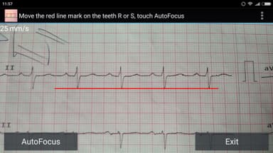 ECG RR Reader (b) APK logo
