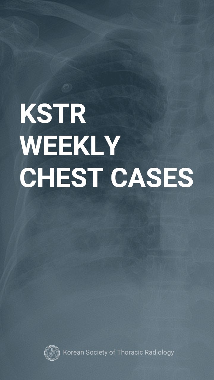 KSTR Weekly Chest Cases APK screenshot 1