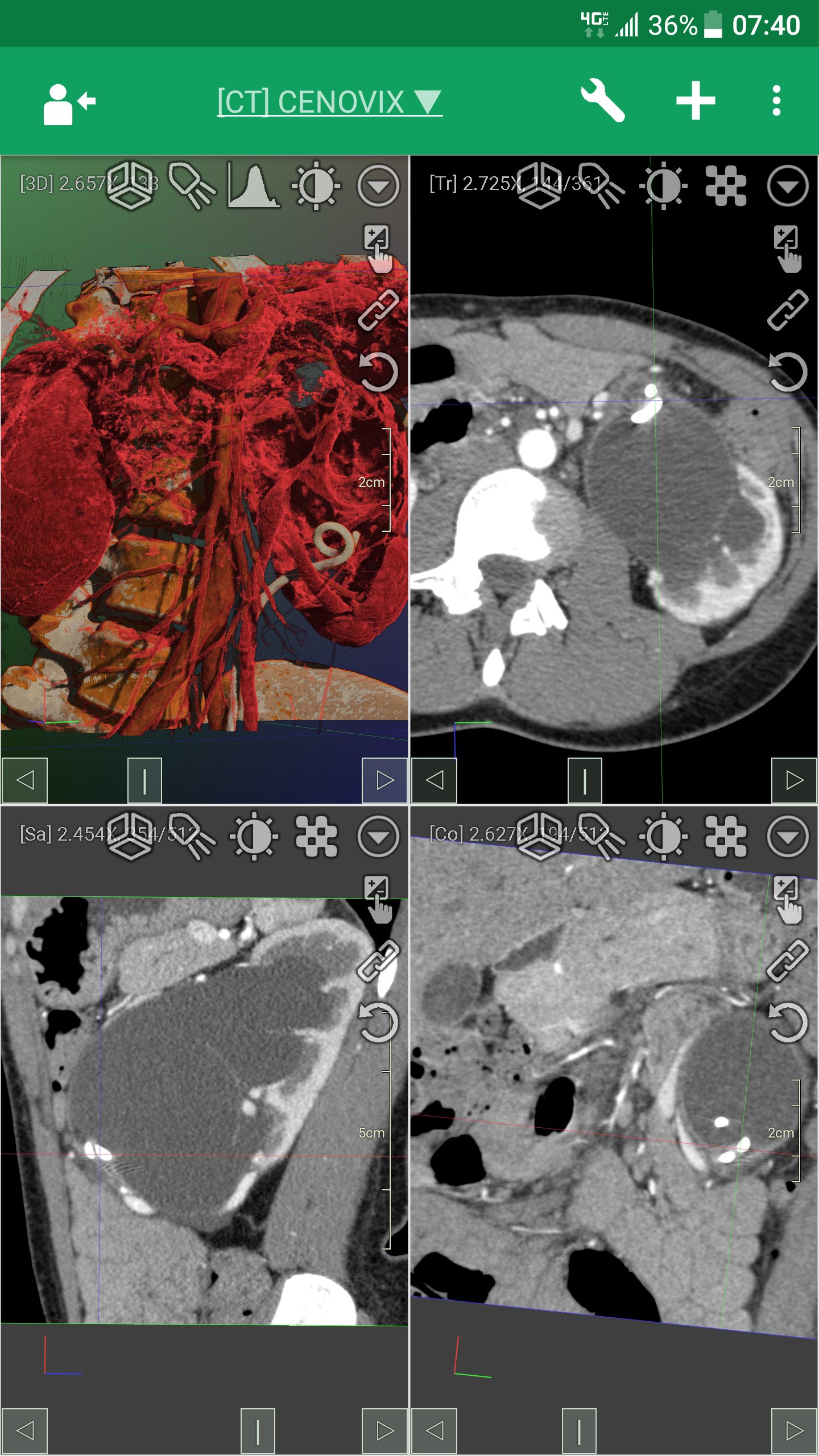 DroidRender - 3D DICOM viewer APK screenshot 1