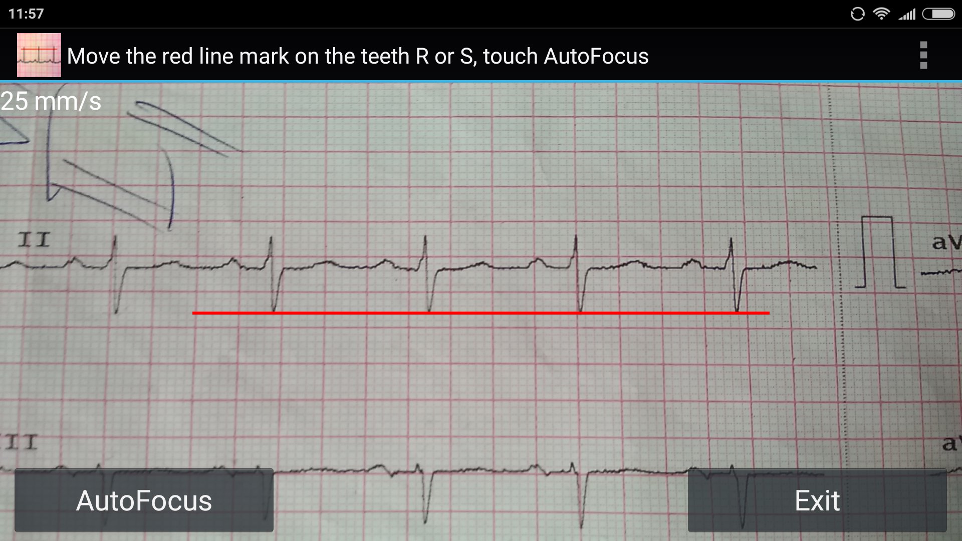 ECG RR Reader (b) APK screenshot 1